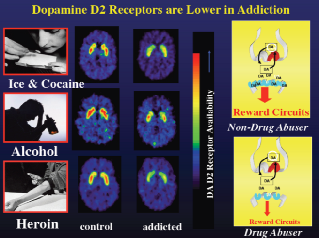 dopaminen-reseptors